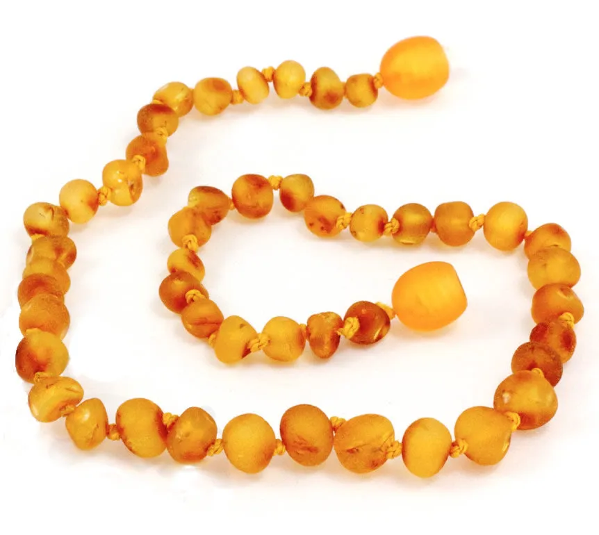 Momma Goose Amber Teething Necklace-Unpolished Honey