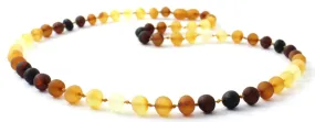 Unpolished Amber Adult Necklace Multi Color Various Sizes